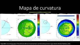 Topografía corneal [upl. by Bria]