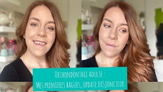 Orthodontie adulte  mes premières bagues  Update Disjoncteur [upl. by Enneira672]