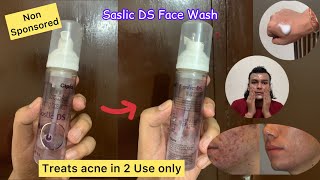 Saslic DS Face Wash Review  Saslic Foaming Face Wash Review [upl. by Nidak364]