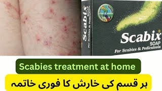 Scabix soap uses in Urdu scabies treatment at home scabix soap  pediculosis [upl. by Namyac464]