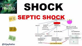 SHOCK Types Pathogenesis of Septic Shock [upl. by Akcirre]