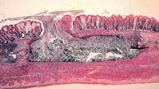 Entamoeba histolytica [upl. by Ertemed]