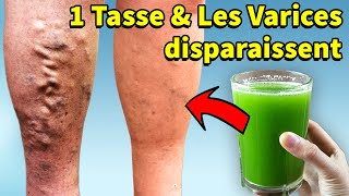 Enlever Les Varices Sur Les Jambes Avec 4 Ingrédients  Remède Maison Pour Les Varices [upl. by Ailugram]