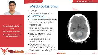 Tumores del Sistema Nervioso  Neurología  Villamedic Clínicas [upl. by Minoru]