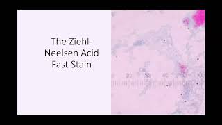 ZiehlNeelsen Acid Fast Stain [upl. by Zaslow]