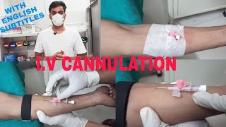 Intravenous Cannulation Technique  Iv Cannulation Procedure [upl. by Lacee786]