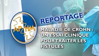 Maladie de Crohn  un essai clinique pour traiter les fistules [upl. by Nalrah]