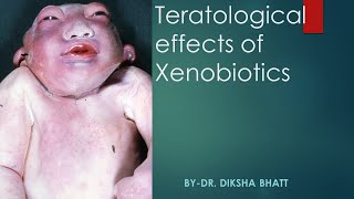 Teratological effect of Xenobiotics By Bhatt Maam [upl. by Costanza549]