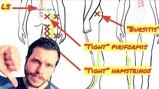 Trigger Point Release for Piriformis Muscle Not Working [upl. by Massiw]