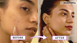 How To Improve Your Skin Texture  Skincare Tips For Bumpy Skin  Be Beautiful [upl. by Ogu]