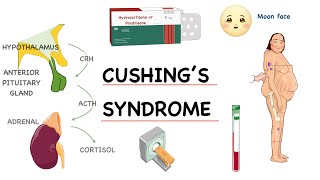 ‎⭕ شرح مفصل خطوة بخطوة لـ  Pathophysiology of Cushing’s Syndrome [upl. by Yelwah176]