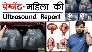 Pregnancy Ultrasound  Ultrasound Report  Medical  Doctor  MBBS  BHMS  BAMS  Nursing [upl. by Annaillil]