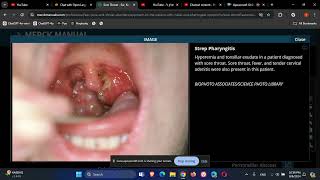 Otolaryngology ENT Sore Throat [upl. by Ladnek]