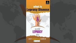 Leprosy  Leprosy Cause Symptoms Treatment Prevention Leprosy In Hindi Leprosy shorts nursing [upl. by Iaria]