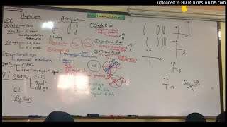 32 Dr Wael Salah astigmatism anisometropia [upl. by Chemaram]