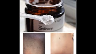 How to use the Ordinary LAscorbic Acid Powder For Bright Glowing Skin 2019 [upl. by Ahsilif]