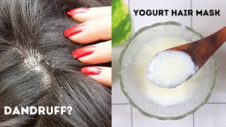 Yogurt Hair Mask  Dandruff Removal Treatment at Home  Yogurt For Dandruff [upl. by Demahom]