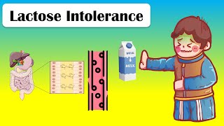 What is Lactose Intolerance  UCLA Digestive Diseases [upl. by Neyut]