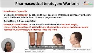 Teratogenesis part 2 [upl. by Ahsiken]