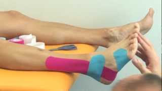 Kinesiology taping  Tejping kotníku oboustranně  varianta II [upl. by Brufsky149]