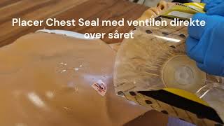 Chest Seal [upl. by Norty818]