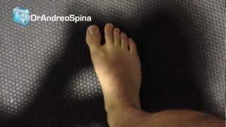 Intrinsic Foot Strengthening by Dr Spina [upl. by Reiners]