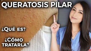 Queratosis Pilar o PIEL DE GALLINA l ¿Qué es y cómo tratarla l Dra Pau Zúñiga👩🏻‍⚕️ [upl. by Obola]