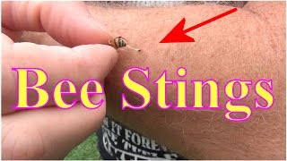 Beekeeping Bee Stings Ouch Stung By A Honey Bee Now What [upl. by Lednyc938]