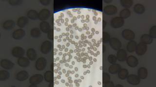 Looking at Mushroom Spores Under a Microscope shorts shortvideo microscope mushroom spore [upl. by Emmit535]