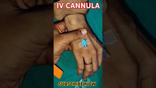 IV CANNULA INSERTION 🩺💉🩺💉🩺💉💉💉💉💉🩺💉cannula youtubeshorts shortshospital viral medicarenurshing [upl. by Salomi]