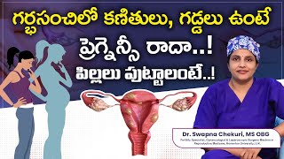 Understanding Uterine Fibroids And Causes  DrSwapna Chekuri  Hyderabad Fertility Center [upl. by Eznyl680]