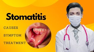 quotStomatitis Symptoms Causes and Treatment  Comprehensive Guide for Oral Healthquot [upl. by Cacie273]