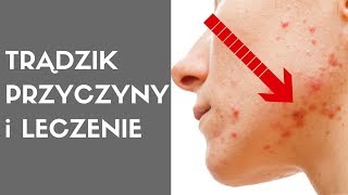 Dermatolog o trądziku TRĄDZIK  przyczyny i leczenie [upl. by Adamski]