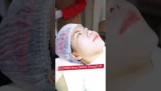 Mancung amp VShape Instan Ala Artis Korea gloskin treatment threadlift klinikkecantikanjakarta [upl. by Bibbie]