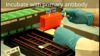 Immunohistochemistry  Procedure [upl. by Esbenshade]