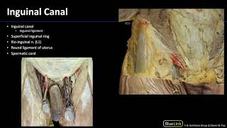 Abdominal Muscles amp Inguinal Canal  Dissection Supplement [upl. by Nimajaneb]