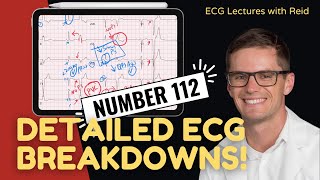 EKG Test Yourself  ECG Case Study 112 [upl. by Dellora755]