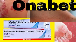 Onabet Cream  Sertaconazole Nitrate Cream Uses in Hindi [upl. by Enelyaj]