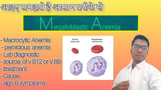 Megaloblastic Anemia medicalentranceexam neetcutoffformedicalcollege preparation pathology [upl. by Ytok515]