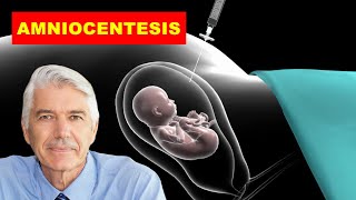 AMNIOCENTESIS MEDICAL DEFINITION OF AMNIOCENTESIS WHAT IS AMNIOCENTESIS [upl. by Bartholomew253]