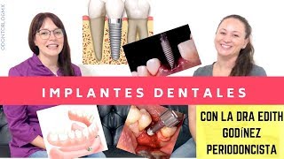 TODO SOBRE Implantes Dentales 🔩 🦷 con Dra Edith Godínez Padilla [upl. by Attirb]