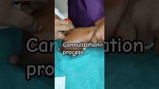 The Canulization Process A StepbyStep Guide trending hospital criticalcare emergency [upl. by Grearson]