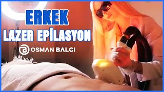 Erkek Lazer Epilasyon [upl. by Arrat]