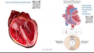Herz 3 Herzzyklus  Systole und Diastole [upl. by Giacobo407]