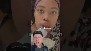 Dead Skin From LIP REDUCTION Surgery  Plastic Surgeon Reacts [upl. by Nnilsia]