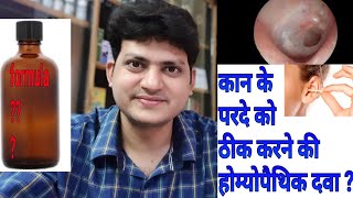 कान का पर्दा फटना । Homeopathic Medicine For Perforated Eardrum  explain  My formula [upl. by Nylirac]