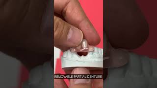 REMOVABLE PARTIAL DENTURE dentist [upl. by Euqina364]