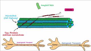 Alzheimers Disease  plaques tangles pathogenesis risk factors disease progression [upl. by Prestige621]