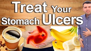 Do This And Cure Your Stomach Pain Gastritis and Ulcers  Best Natural Treatment of Stomach Pain [upl. by Iruahs]