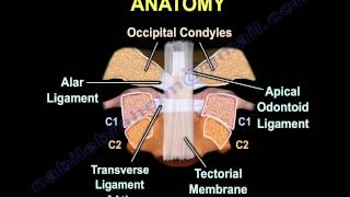 Occipital Condyle Fractures  Everything You Need To Know  Dr Nabil Ebraheim [upl. by Oakman]